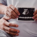 Erkek Fertilitesinin Değerlendirmesi