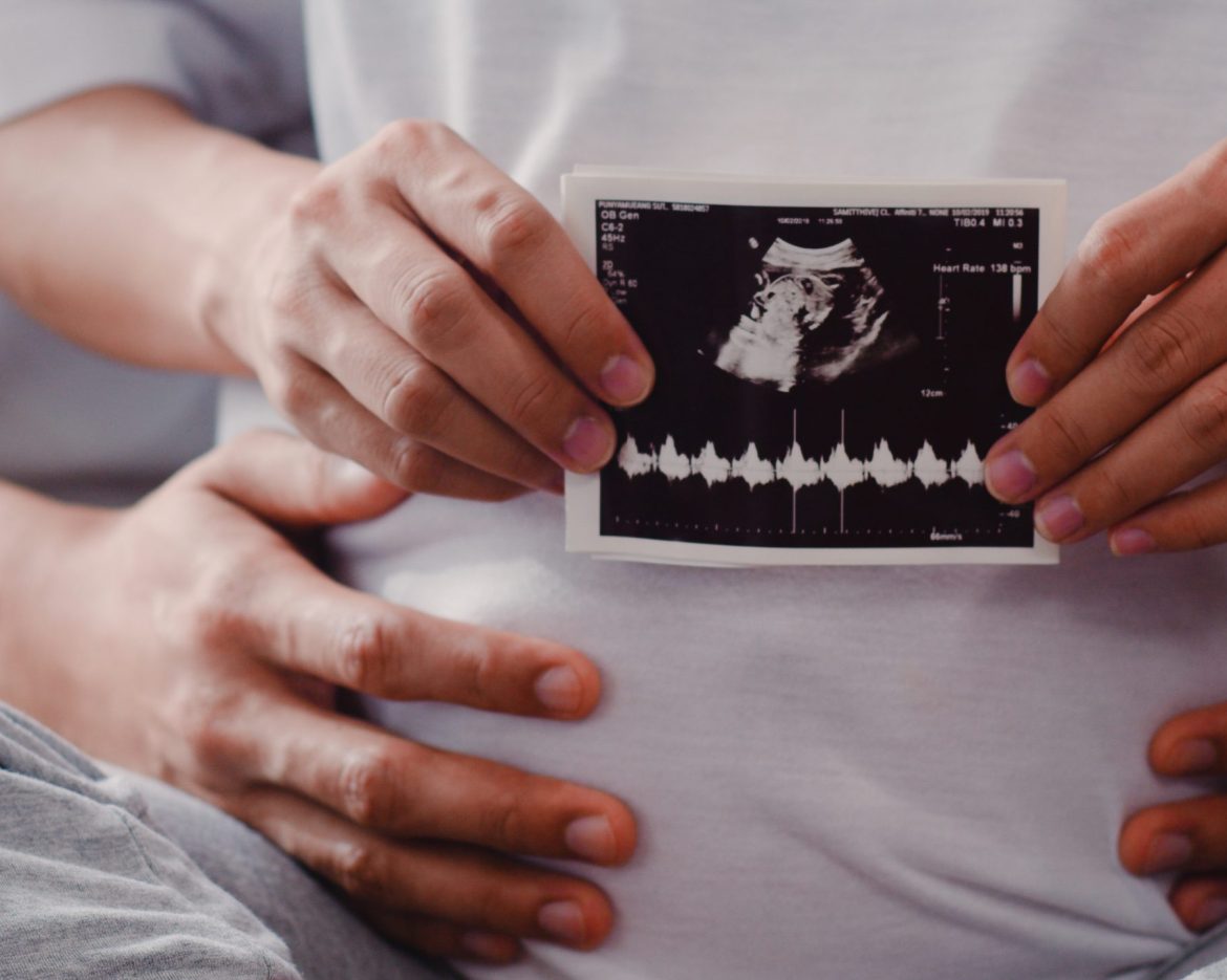 Young Asian Pregnant couple show and looking ultrasound photo ba