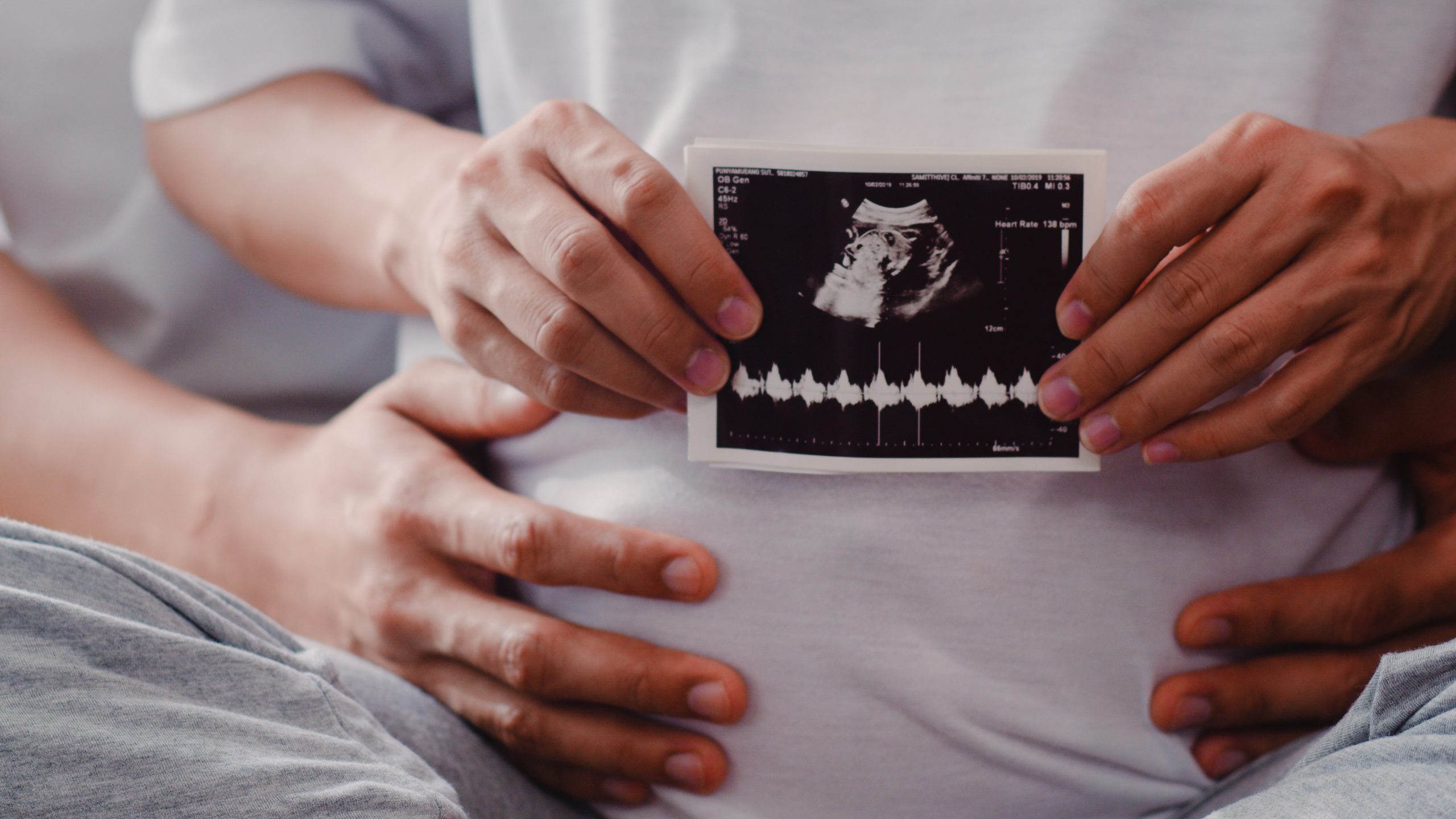 Young Asian Pregnant couple show and looking ultrasound photo ba