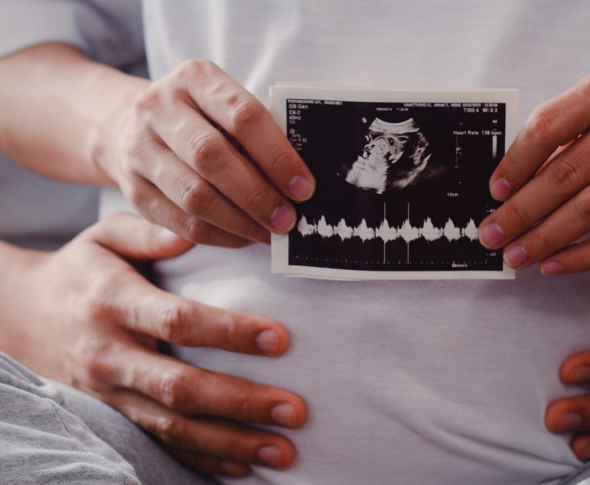 Young Asian Pregnant couple show and looking ultrasound photo ba