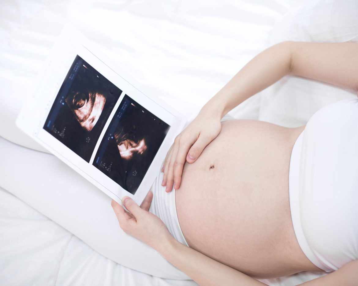 Close up of pregnant woman holding ultrasound scan on her tummy