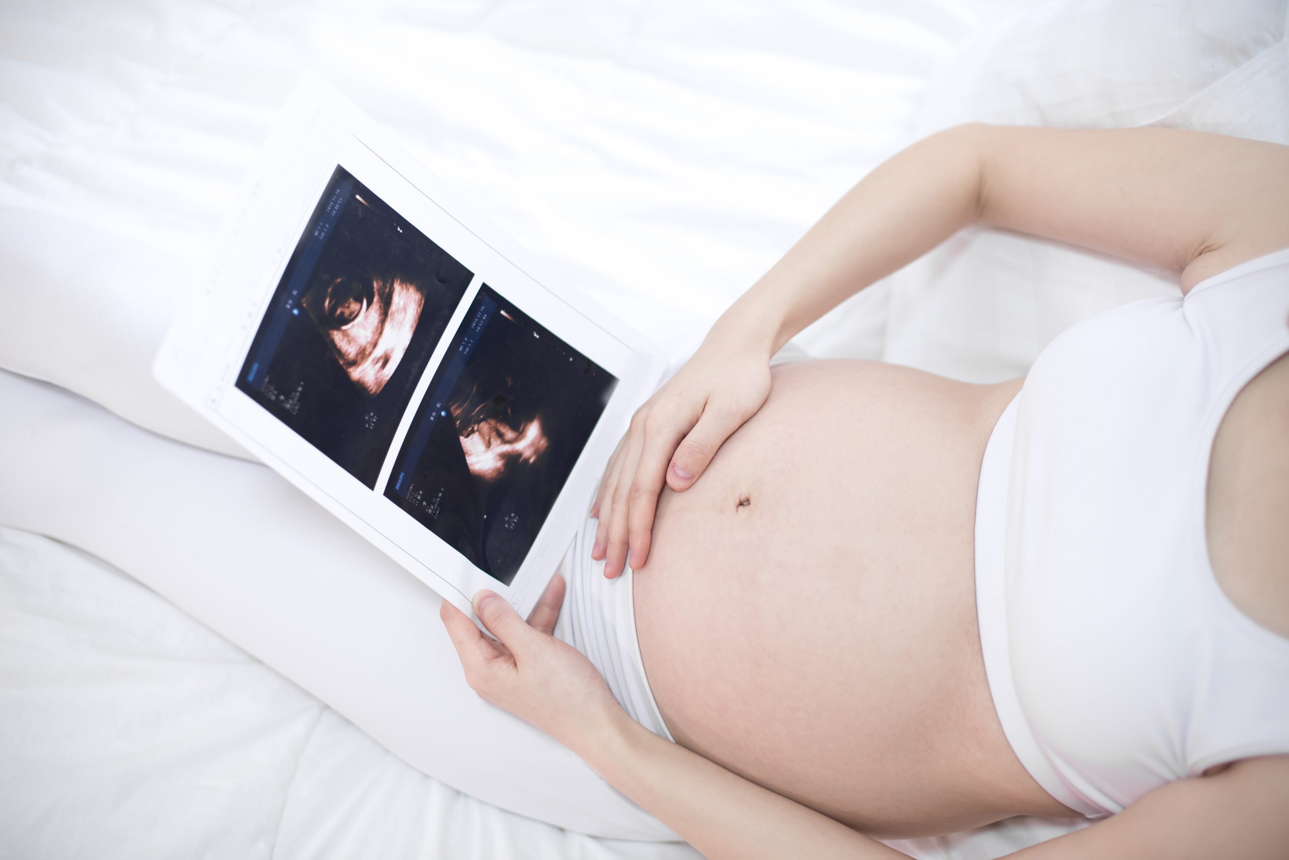 Close up of pregnant woman holding ultrasound scan on her tummy