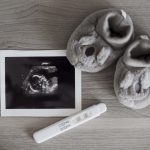 Tüp Bebek Gebeliklerinde Dikkat Edilmesi Gereken Konular